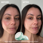 Before and after comparison of a woman's face showing skincare results, with a small open jar of Marine Miracle Crème at the bottom center. The left side is labeled BEFORE and shows more redness/irregularity, while the right side is labeled AFTER and shows smoother, clearer skin.