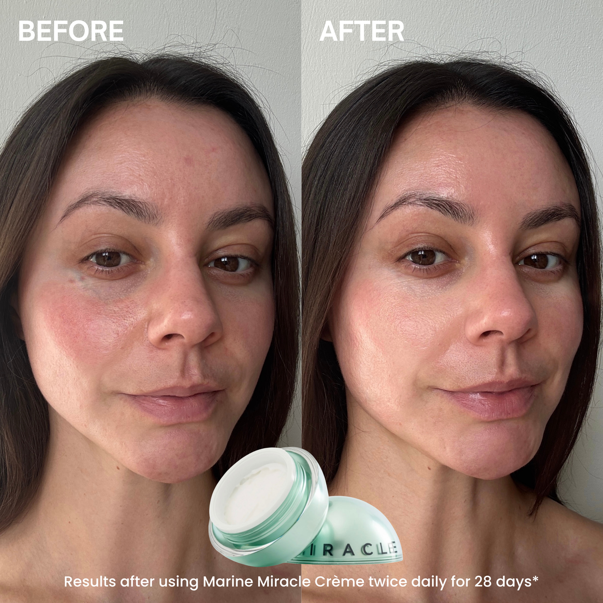 Before and after comparison of a woman's face showing skincare results, with a small open jar of Marine Miracle Crème at the bottom center. The left side is labeled BEFORE and shows more redness/irregularity, while the right side is labeled AFTER and shows smoother, clearer skin.