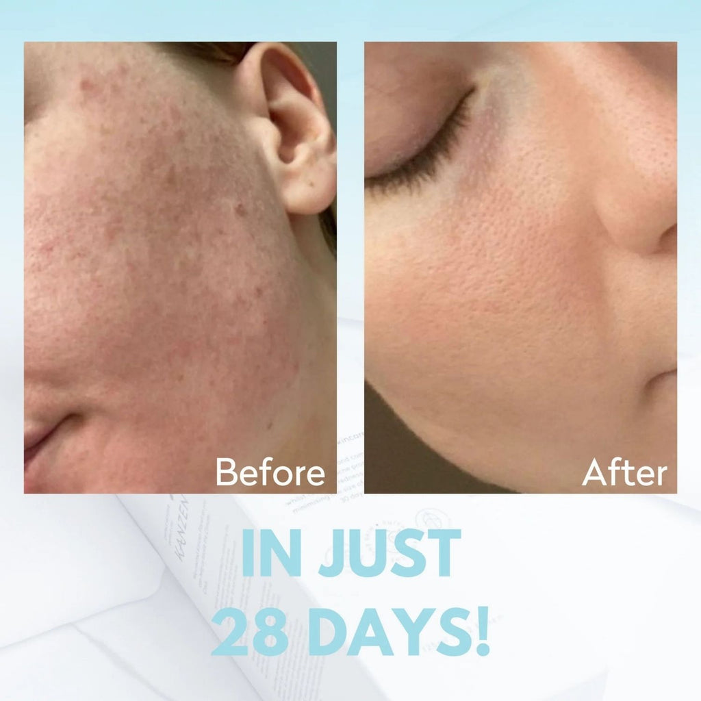 Before and after images using hypochlorous water.