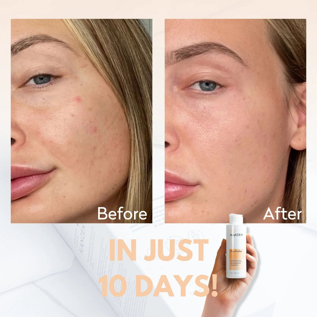 Kanzen Skincare Derma Pore Purifier 125ml