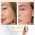 Kanzen Skincare Derma Pore Purifier 125ml