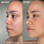 before and after model of using the lipvolume serum