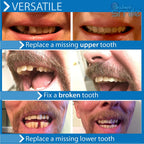 Instant Smile Pro Series Temporary Tooth Replacement Kit