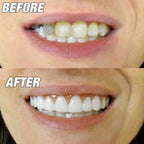 Instant Smile Comfort Fit Flex Cosmetic Teeth - Bright White